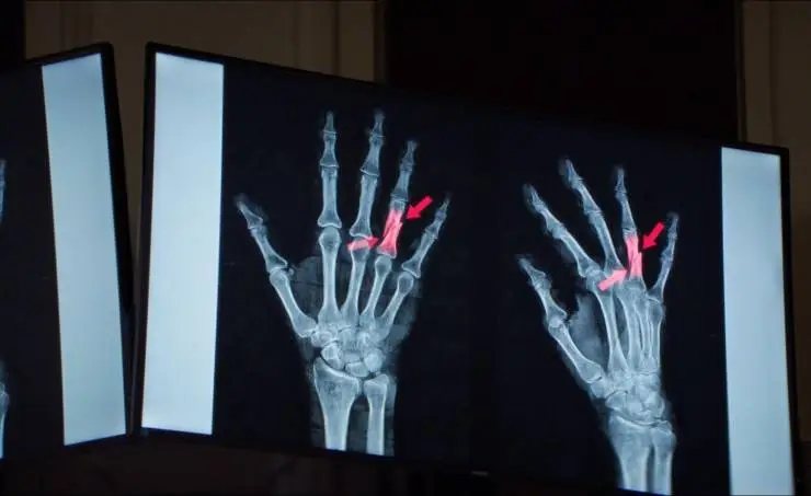 Анатомия падения (2023) в хорошем качестве смотреть онлайн Анатомия падения (2023) фильм в хорошем качестве смотреть онлайн