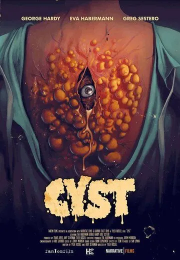 Киста / Cyst (2020) фильм смотреть онлайн Киста / Cyst (2020) фильм смотреть онлайн в хорошем качестве