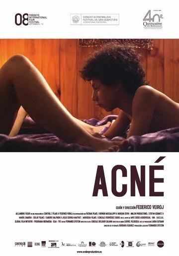 Угри / Acné (2008) фильм смотреть онлайн Угри / Acné (2008) фильм смотреть онлайн в хорошем качестве
